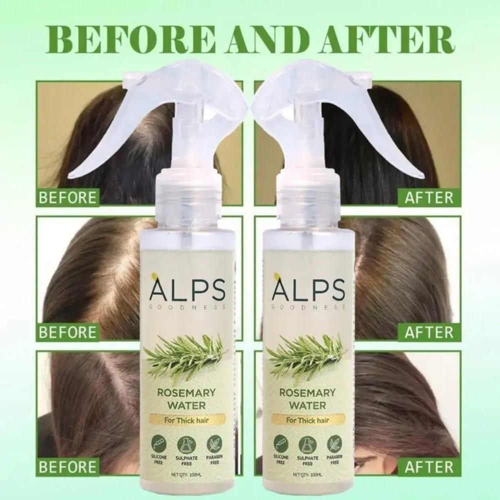 Rosemary Water, Hair Spray For Regrowth | Buy 1 Get 2 free