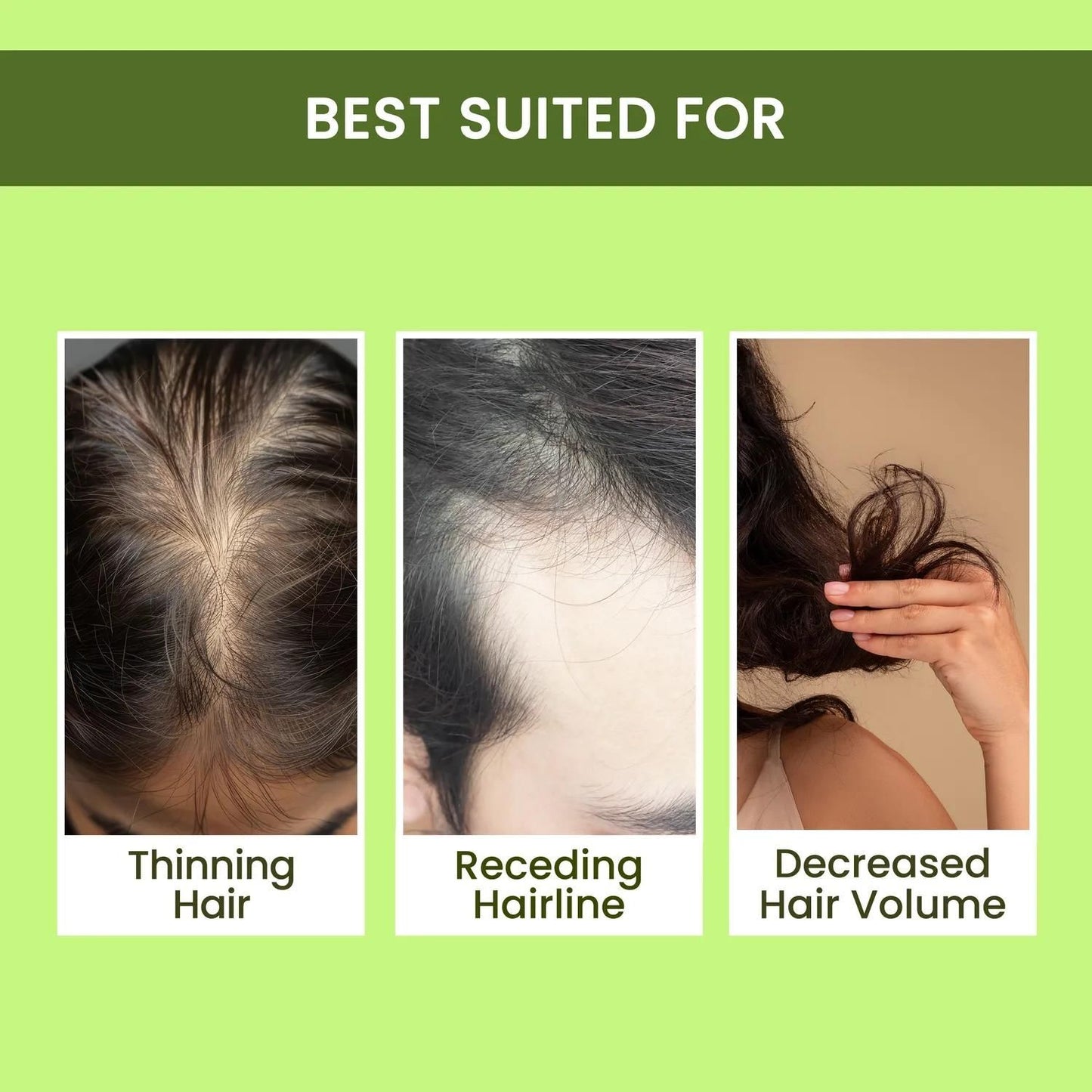 Rosemary Water, Hair Spray For Regrowth | Buy 1 Get 2 free